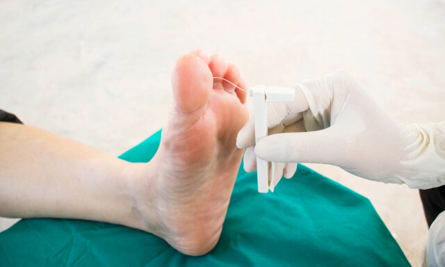 MONOFILAMENT TEST: Her sjekker legen berøringsans med monofilamentundersøkelse. FOTO: Scanpix NTB / Shutterstock / memorisz MONOFILAMENT TEST: Her sjekker legen berøringsans med monofilamentundersøkelse. FOTO: Scanpix NTB / Shutterstock / memorisz